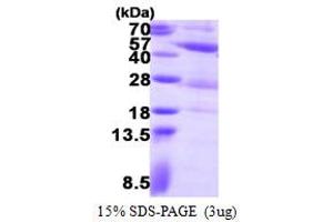 Phosphoglycerate Kinase 2 (PGK2) (AA 1-417) protein (His tag)