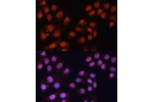 Immunofluorescence analysis of HeLa cells using CDK11B antibody (ABIN6130092, ABIN6138305, ABIN6138306 and ABIN6216598) at dilution of 1:100. (CDK11 抗体  (AA 1-130))