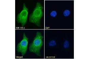ABIN190834 Immunofluorescence analysis of paraformaldehyde fixed HeLa cells, permeabilized with 0.