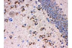 Immunohistochemistry (IHC) image for anti-Amyloid beta (A4) Precursor Protein-Binding, Family B, Member 1 (Fe65) (APBB1) (AA 21-56), (N-Term) antibody (ABIN3043784)