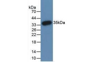 Western blot analysis of recombinant Human PADI3. (PADI3 抗体  (AA 1-300))