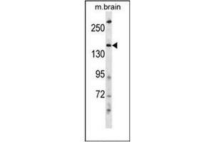Western blot analysis of HECW2 Antibody (Center) in mouse brain tissue lysates (35ug/lane).