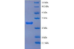 SDS-PAGE (SDS) image for Peptide YY (PYY) (AA 31-64), (full length) protein (GST tag) (ABIN1047502)