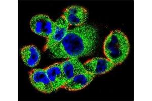 Confocal immunofluorescent analysis of SOCS4 antibody with A2058 cells followed by Alexa Fluor 488-conjugated goat anti-rabbit lgG (green). (SOCS4 抗体  (AA 227-254))