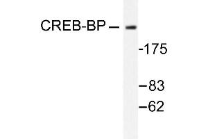 Image no. 1 for anti-CREB Binding Protein (CREBBP) antibody (ABIN265372) (CBP 抗体)