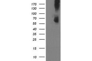 Western Blotting (WB) image for anti-phosphodiesterase 1B, Calmodulin-Dependent (PDE1B) antibody (ABIN1500075) (PDE1B 抗体)