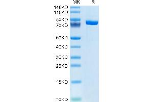 Human FXI on Tris-Bis PAGE under reduced condition. (Factor XI Protein (AA 19-625) (His tag))