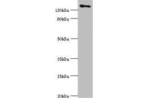Western blot All lanes: USP8 antibody at 14 μg/mL + 293T whole cell lysate Secondary Goat polyclonal to rabbit IgG at 1/10000 dilution Predicted band size: 128, 116 kDa Observed band size: 128 kDa