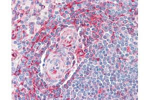 anti-Major Vault Protein (MVP) (AA 1-894) antibody