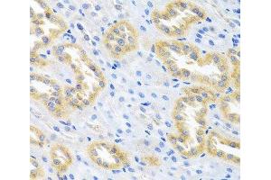 Immunohistochemistry of paraffin-embedded Rat kidney using BMP3 Polyclonal Antibody at dilution of 1:100 (40x lens). (BMP3 抗体)