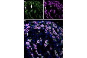 Immunohistochemistry (IHC) image for anti-Transient Receptor Potential Cation Channel, Subfamily M, Member 8 (TRPM8) (AA 917-929), (Extracellular) antibody (ABIN7043837)