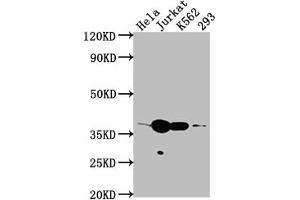 Western Blot Positive WB detected in: Hela whole cell lysate, Jurkat whole cell lysate, K562 whole cell lysate, 293 whole cell lysate All lanes: CDK6 antibody at 1:2000 Secondary Goat polyclonal to rabbit IgG at 1/50000 dilution Predicted band size: 37 kDa Observed band size: 37 kDa (Recombinant CDK6 抗体)