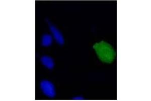 Immunofluorescence (IF) image for anti-Human Papilloma Virus 18 E7 (HPV-18 E7) (AA 1-35), (N-Term) antibody (ABIN781779) (HPV18 E7 抗体  (N-Term))