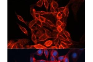 Immunofluorescence (IF) image for anti-Solute Carrier Family 3 (Activators of Dibasic and Neutral Amino Acid Transport), Member 2 (SLC3A2) antibody (ABIN7010781)