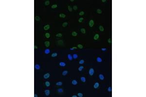 Immunofluorescence analysis of U-2 OS cells using GTF2E1 Polyclonal Antibody (ABIN7267371) at dilution of 1:100 (40x lens). (GTF2E1 抗体  (AA 230-439))