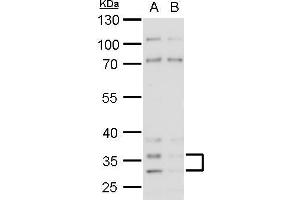 WB Image Histamine H4 Receptor antibody detects Histamine H4 Receptor protein by western blot analysis. (HRH4 抗体  (N-Term))