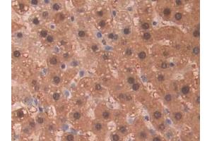 Detection of SDH in Rat Liver Tissue using Polyclonal Antibody to Sorbitol Dehydrogenase (SDH) (SORD 抗体  (AA 2-357))