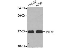 Western blot analysis of extracts of various cell lines, using IFITM1 antibody. (IFITM1 抗体  (C-Term))