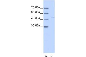 Western Blotting (WB) image for anti-Zinc Finger Protein 555 (ZNF555) antibody (ABIN2461313) (ZNF555 抗体)