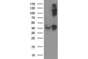 Image no. 2 for anti-Pantothenate Kinase 3 (PANK3) antibody (ABIN1500028) (PANK3 抗体)