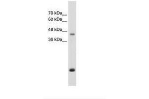 Image no. 2 for anti-Asporin (ASPN) (AA 250-299) antibody (ABIN203462) (Asporin 抗体  (AA 250-299))