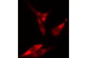 ABIN6266692 staining HeLa cells by IF/ICC. (RANKL 抗体  (Internal Region))