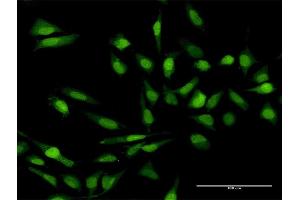 Immunofluorescence of purified MaxPab antibody to IL17C on HeLa cell. (IL17C 抗体  (AA 1-197))