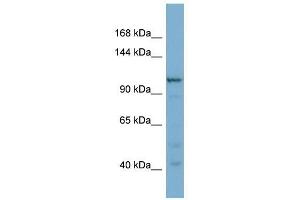 COPG2 antibody used at 1 ug/ml to detect target protein. (COPG2 抗体  (N-Term))