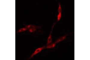 ABIN6275121 staining COLO205 cells by IF/ICC. (EIF3F 抗体  (Internal Region))