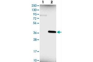 Western blot analysis of Lane 1: Negative control (vector only transfected HEK293T lysate), Lane 2: Over-expression Lysate (Co-expressed with a C-terminal myc-DDK tag (~3. (CHMP6 抗体)