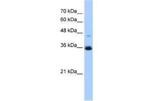 GGPS1 antibody used at 0. (GGPS1 抗体  (C-Term))