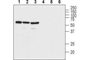 Western blot analysis of rat brain lysate (lanes 1 and 4), mouse brain lysate (lanes 2 and 5), and human Malme-3M melanoma cell lysate (lanes 3 and 6): - 1-3. (VIPR2 抗体  (Extracellular, N-Term))