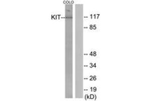 Western blot analysis of extracts from COLO205 cells, using KIT (Ab-936) Antibody. (KIT 抗体  (AA 906-955))