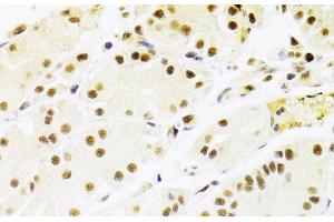 Immunohistochemistry of paraffin-embedded Human stomach using RBPJ Polyclonal Antibody at dilution of 1:100 (40x lens). (RBPJ 抗体)