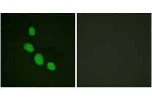 Immunofluorescence analysis of HeLa cells, using C/EBP-epsilon (Ab-74) Antibody. (CEBPE 抗体  (AA 40-89))