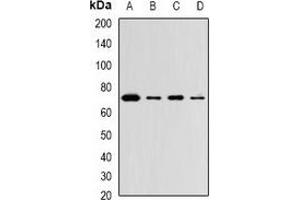 Western blot analysis of ZNF145 expression in Hela (A), THP1 (B), mouse lung (C), mouse brain (D) whole cell lysates. (ZBTB16 抗体)