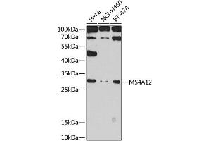 Western blot analysis of extracts of various cell lines, using MS4 antibody (ABIN6131373, ABIN6144052, ABIN6144053 and ABIN6224244) at 1:1000 dilution. (MS4A12 抗体  (AA 1-90))
