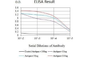 Black line: Control Antigen (100 ng),Purple line: Antigen (10 ng), Blue line: Antigen (50 ng), Red line:Antigen (100 ng) (CCR6 抗体)
