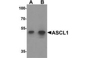 Western blot analysis of ACSL1 in human lung tissue lysate with ACSL1 Antibody  at (A) 1 and (B) 2 μg/ml. (ACSL1 抗体  (Middle Region))