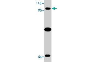 Western blot analysis of TLR6 expression in Jurkat cell lysate with TLR6 polyclonal antibody  at 2 ug/mL . (TLR6 抗体  (N-Term))