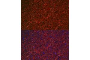 Immunofluorescence (IF) image for anti-Microtubule-Associated Protein 2 (MAP2) (AA 260-559) antibody (ABIN3016265)