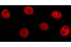 ABIN6274350 staining HuvEc cells by IF/ICC.