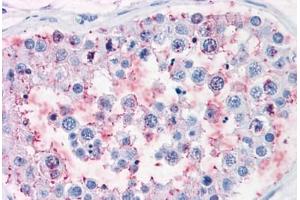 Human Testis: Formalin-Fixed, Paraffin-Embedded (FFPE) (ENPP3 抗体  (Internal Region))