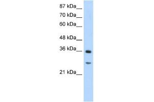WB Suggested Anti-GIPC2 Antibody Titration:  1. (GIPC2 抗体  (N-Term))
