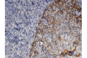 Immunoperoxidase of monoclonal antibody to SNAPIN on formalin-fixed paraffin-embedded human tonsil. (SNAPIN 抗体  (AA 41-136))