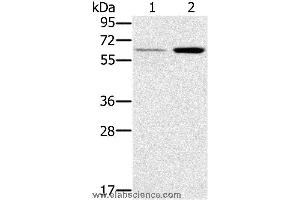 Western blot analysis of Human liver and mouse kidney tissue, using TNFRSF11A Polyclonal Antibody at dilution of 1:200 (TNFRSF11A 抗体)