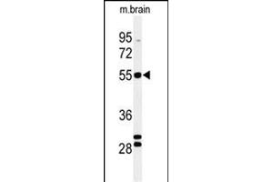 Western blot analysis of FA2H Antibody (Center) (ABIN650994 and ABIN2840028) in mouse brain tissue lysates (35 μg/lane). (FA2H 抗体  (AA 121-148))