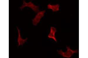 Immunofluorescence (fixed cells) (IF/ICC) image for anti-Signal Transducer and Activator of Transcription 3 (Acute-Phase Response Factor) (STAT3) (C-Term) antibody (ABIN6265317)