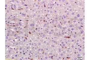 Formalin-fixed and paraffin embedded rat liver labeled with Rabbit Anti LIF Polyclonal Antibody, Unconjugated (ABIN737046) at 1:200 followed by conjugation to the secondary antibody and DAB staining (LIF 抗体  (AA 101-202))