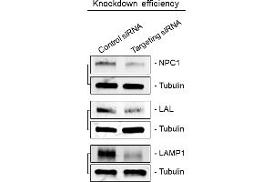 Immunoblots showing knockdown efficiency of siRNA transfections related to Figure 3A. (Lipase A 抗体  (Center))